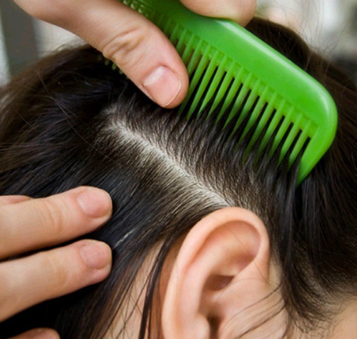 Что необходимо делать, чтобы волосы перестали выпадать с луковицей