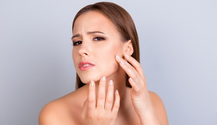 Прыщи на щеках – как уберечь себя от эстетического дефекта?